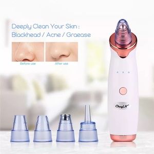 Face/Body Vaccum Blackhead Remover